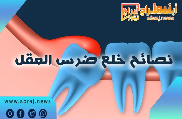 نصائح خلع ضرس العقل
