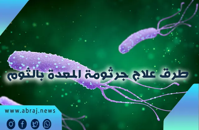 طرق علاج جرثومة المعدة بالثوم
