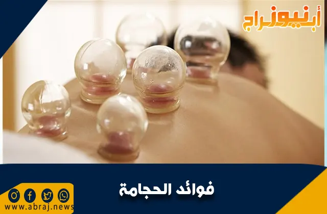 فوائد الحجامة