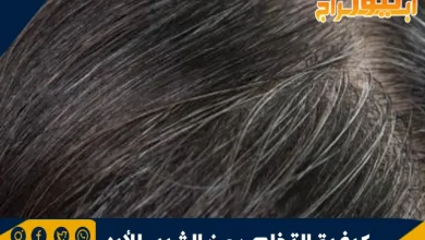 كيفية التخلص من الشيب للأبد .. طب الأعشاب التقليدي 7 كيفية التخلص من الشيب للأبد