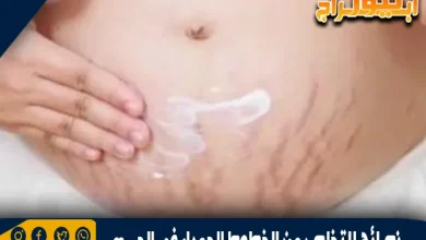 نصائح للتخلص من الخطوط الحمراء في الجسم