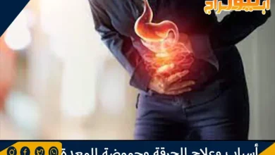 أسباب وعلاج الحرقة وحموضة المعدة وأهم النصائح 12 أسباب وعلاج الحرقة وحموضة المعدة وأهم النصائح
