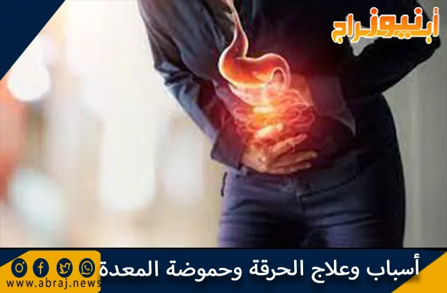 أسباب وعلاج الحرقة وحموضة المعدة وأهم النصائح