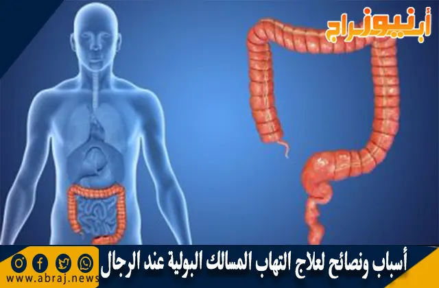 أسباب ونصائح لعلاج التهاب المسالك البولية عند الرجال