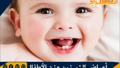 أعراض التسنين عند الأطفال ونصائح لتسكين ألم التسنين 5 أعراض التسنين عند الأطفال ونصائح لتسكين ألم التسنين