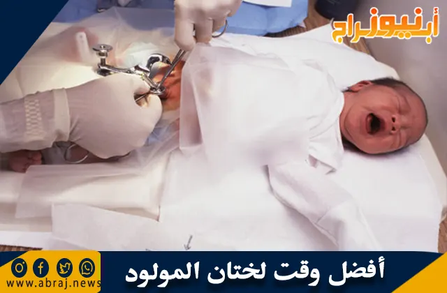 أفضل وقت لختان المولود