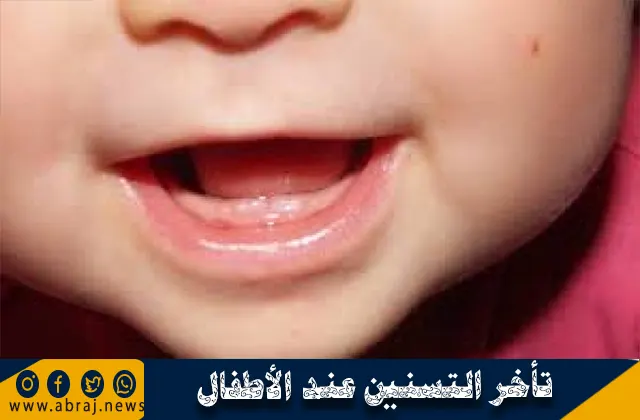 تأخر التسنين عند الأطفال ونصائح لتسريع التسنين