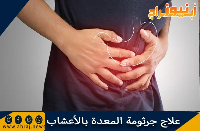 علاج جرثومة المعدة بالأعشاب ونصائح للوقاية من جرثومة المعدة