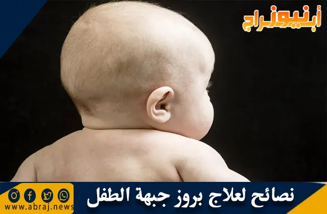 نصائح لعلاج بروز جبهة الطفل