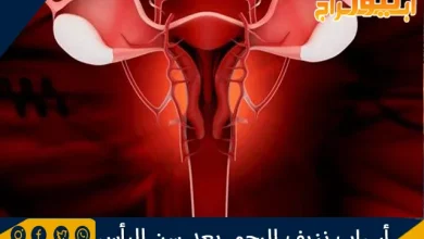 أسباب نزيف الرحم بعد سن اليأس ونصائح لعلاجه 11 أسباب نزيف الرحم بعد سن اليأس ونصائح لعلاجه