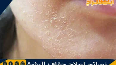 نصائح لعلاج جفاف البشرة 5 نصائح لعلاج جفاف البشرة