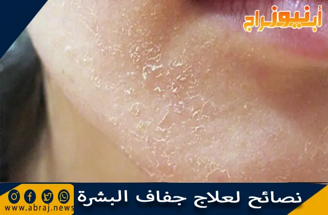 نصائح لعلاج جفاف البشرة