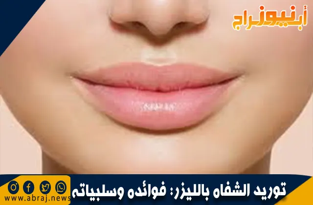 توريد الشفاه بالليزر