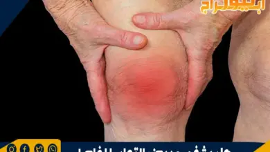 هل يشفي مريض التهاب المفاصل 6 هل يشفي مريض التهاب المفاصل