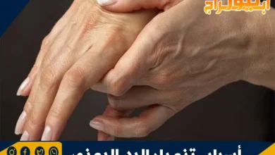 أسباب تنميل اليد اليمنى 4 أسباب تنميل اليد اليمنى