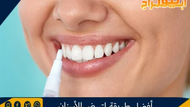 أفضل طريقة لتبيض الأسنان 2 طريقة لتبيض الأسنان
