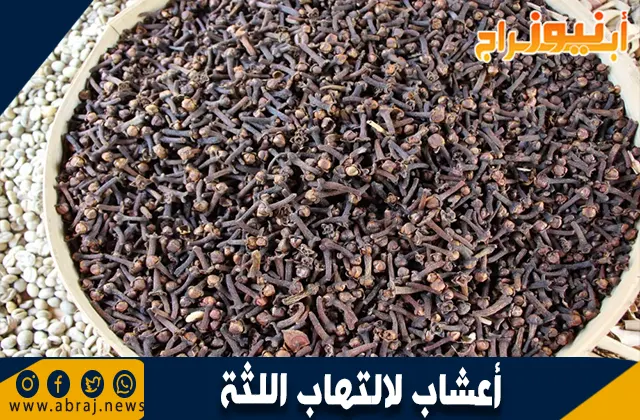 التهاب اللثة