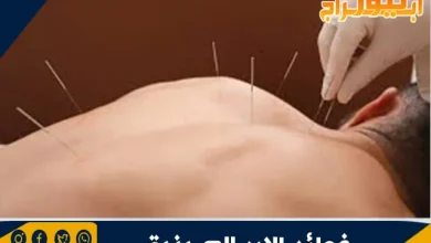 فوائد الإبر الصينية للأعصاب 7 فوائد الإبر الصينية للأعصاب