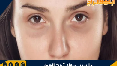 ما سبب سواد تحت العين 7 سبب سواد تحت العين