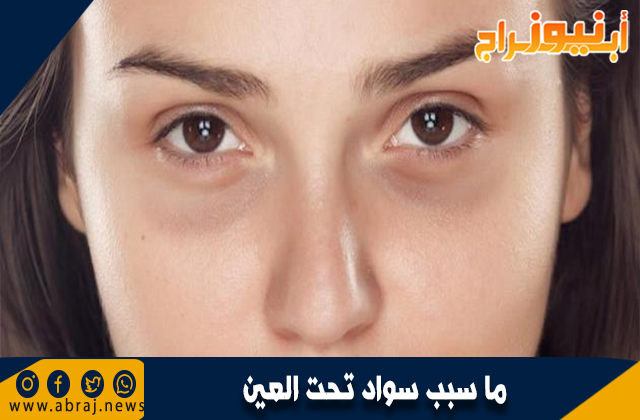 سبب سواد تحت العين