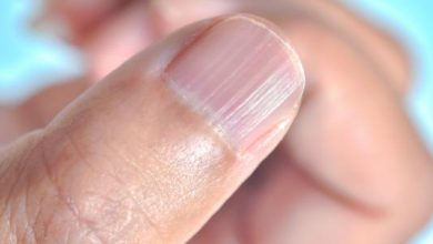 أعراض نقص الزنك: دليل شامل للتعرف على العلامات وعلاجها 2 أعراض نقص الزنك