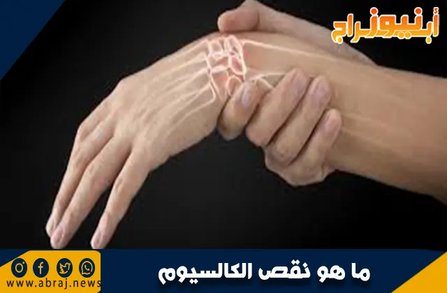 ما هو نقص الكالسيوم