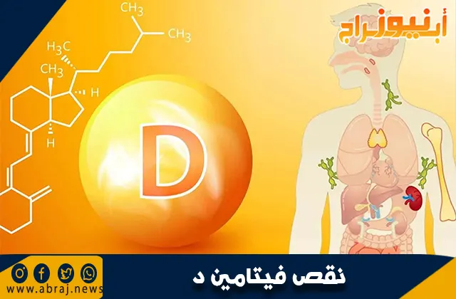 نقص فيتامين د